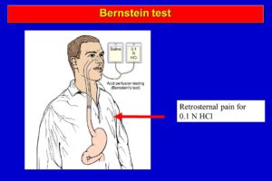 Bernstein-Test
