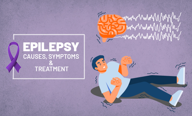 Epilepsy
