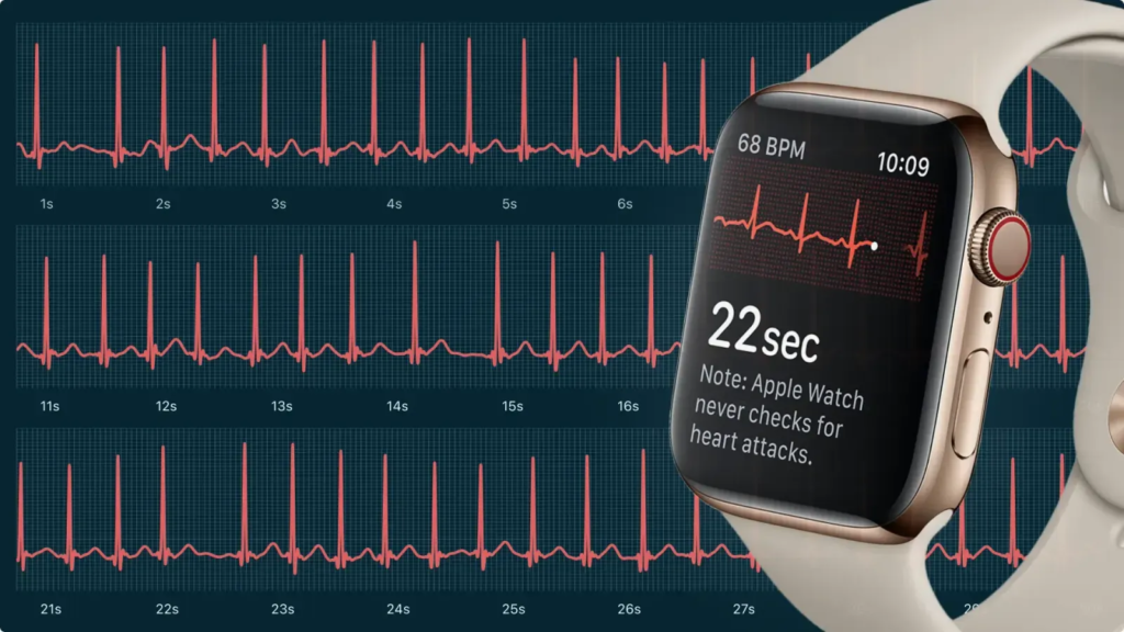 Apple received FDA clearance for its ECG app