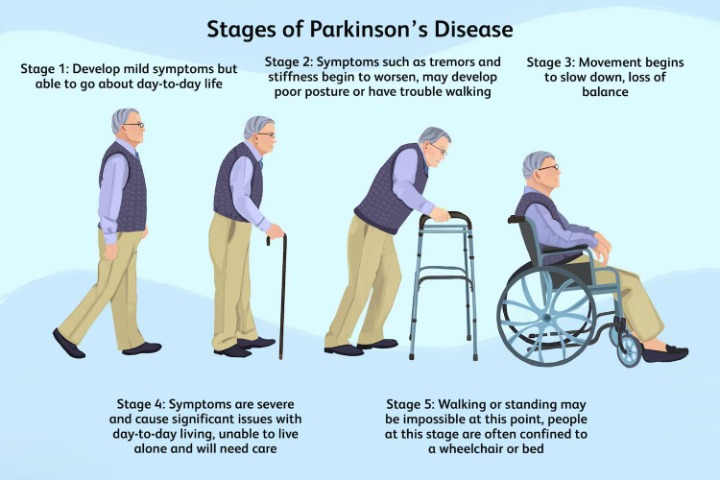 Parkinson's Disease