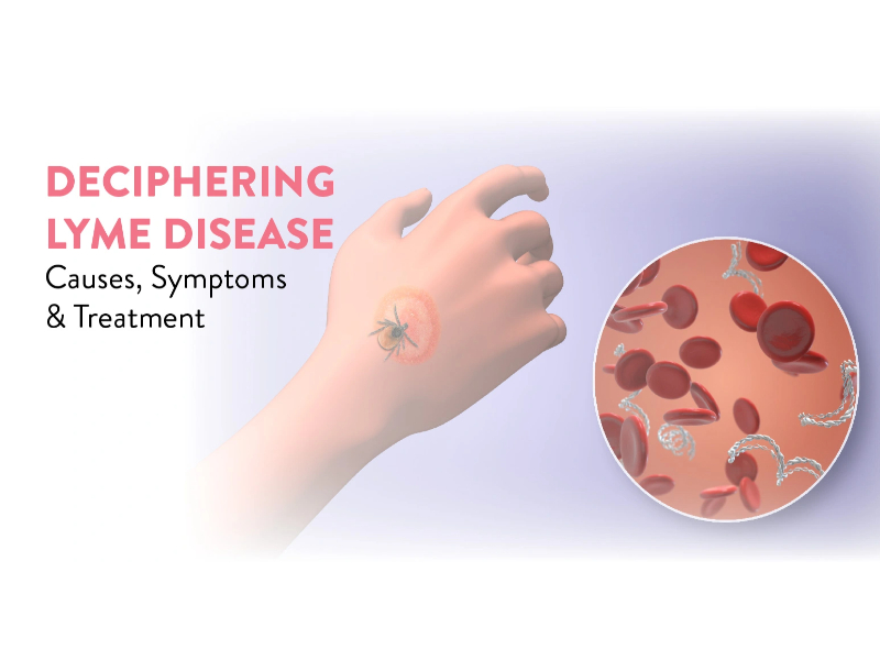 Lyme Disease
